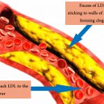 difference between ldl-and-hdl