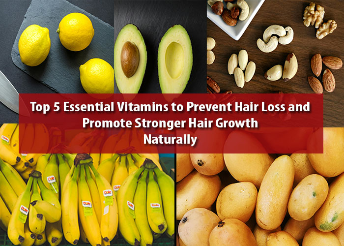 5 essential vitamins to prevent hair loss