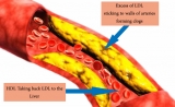 Difference between LDL (Bad Cholesterol) and HDL (Good Cholesterol)